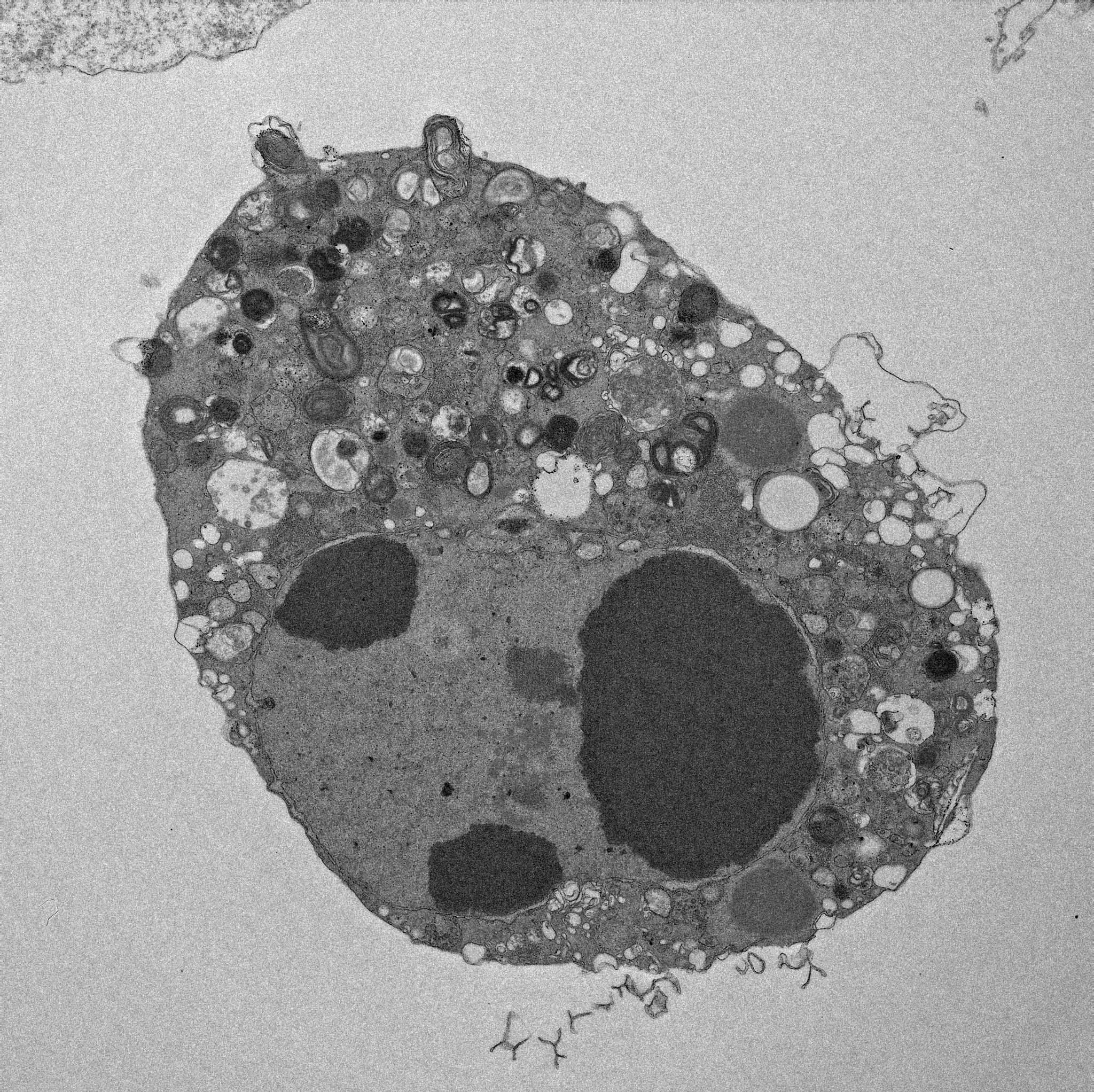 SARS-CoV-2 electron microscopy image