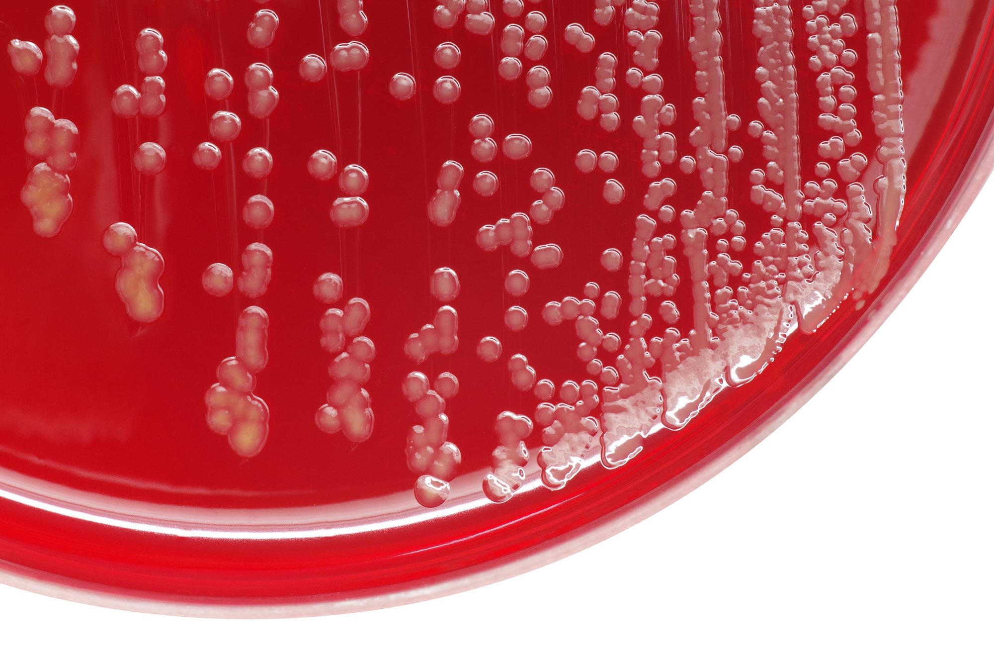 Staphylococcus aureus bacterial colonies