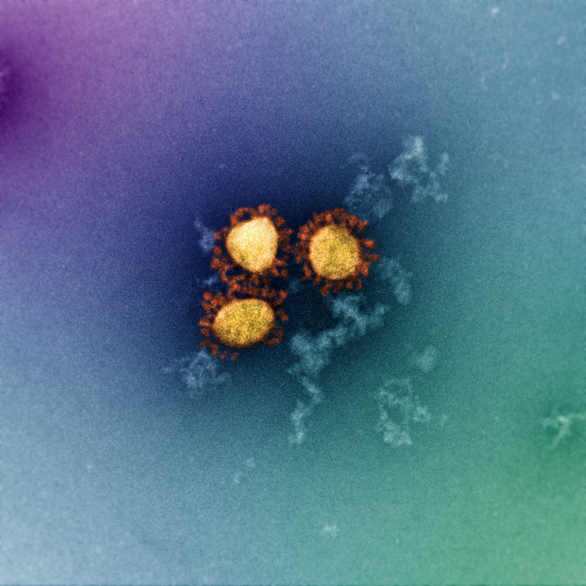Electron microscopy image of Omicron, SARS-CoV-2 variant.