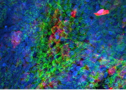 Spotlight on Therapeutics: How are human organoids shaping the future of pandemic response?