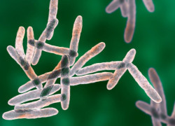 Common belief regarding Mycobacterium tuberculosis infection and tuberculosis disease disproven more than a century ago